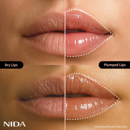 NIDA Retinol Glowy Lip Serum NIDA